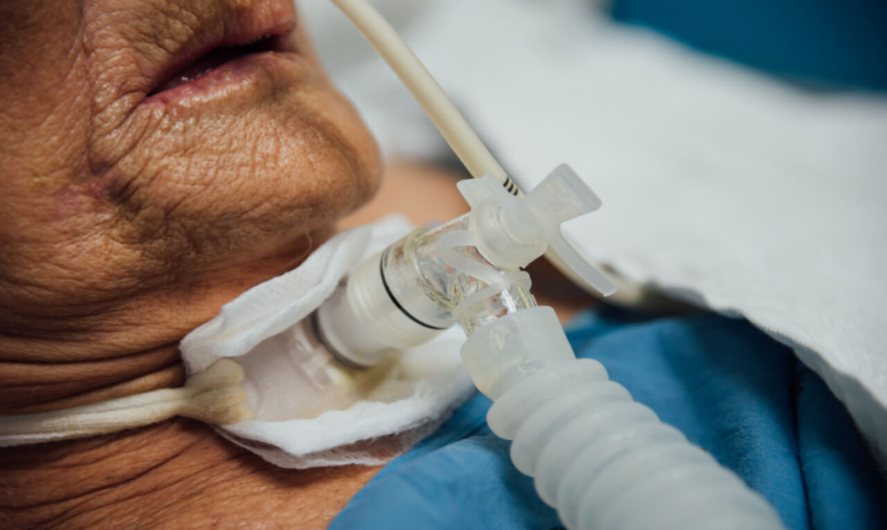 Pacientes com traqueostomia têm significativas limitações no dia a dia, como dificuldades para respirar, se alimentar e falar