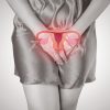 Endometriose pode gerar câncer? Entenda