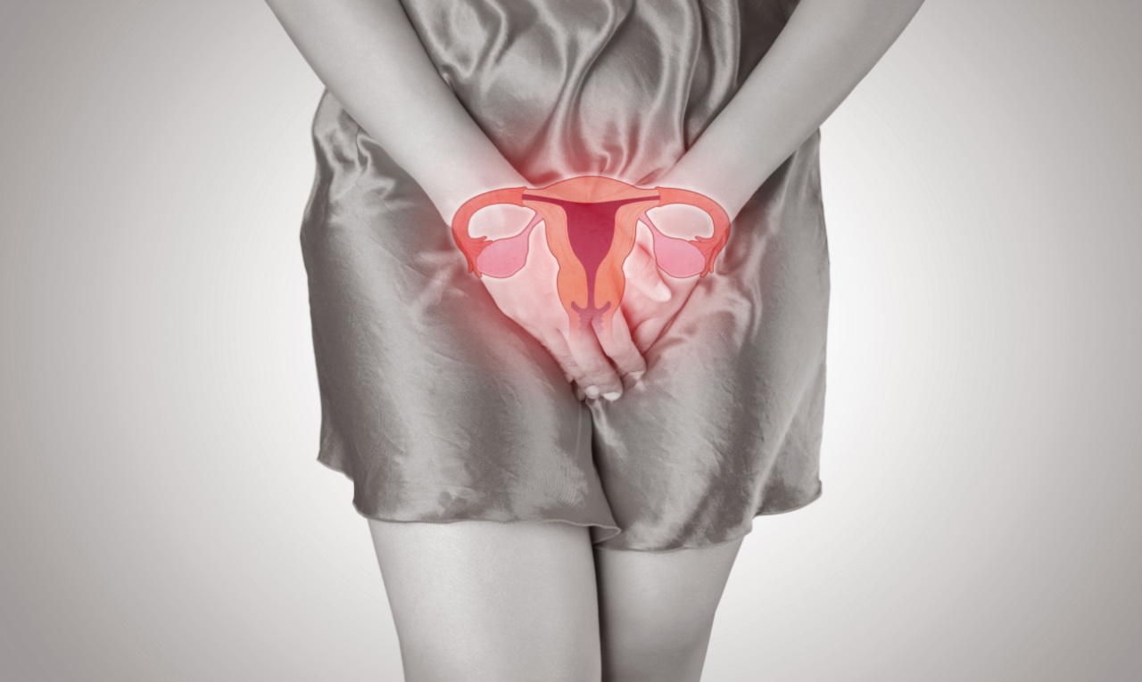 Endometriose pode gerar câncer? Entenda