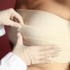 Mastopexia e mamoplastia sem silicone: entenda como são as cirurgias