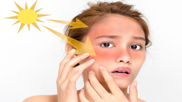 Além do protetor solar: veja como cuidar da sua pele no calor