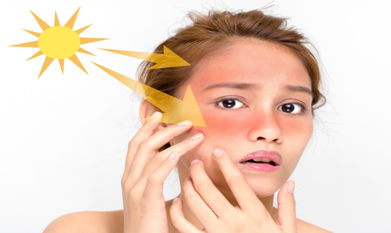 Além do protetor solar: veja como cuidar da sua pele no calor