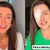 Influencer tem inflamação na córnea após usar cera para cabelo; entenda