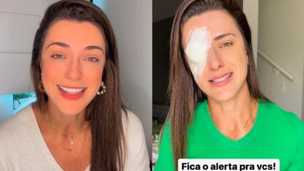 Influencer tem inflamação na córnea após usar cera para cabelo; entenda