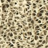 Silenciosa e perigosa: conheça os sinais da osteoporose