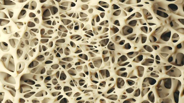 Silenciosa e perigosa: conheça os sinais da osteoporose