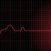 Parada cardíaca: o que é, causas e consequências