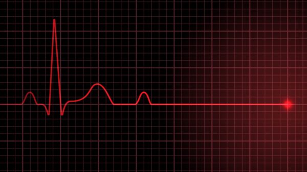 Parada cardíaca: o que é, causas e consequências