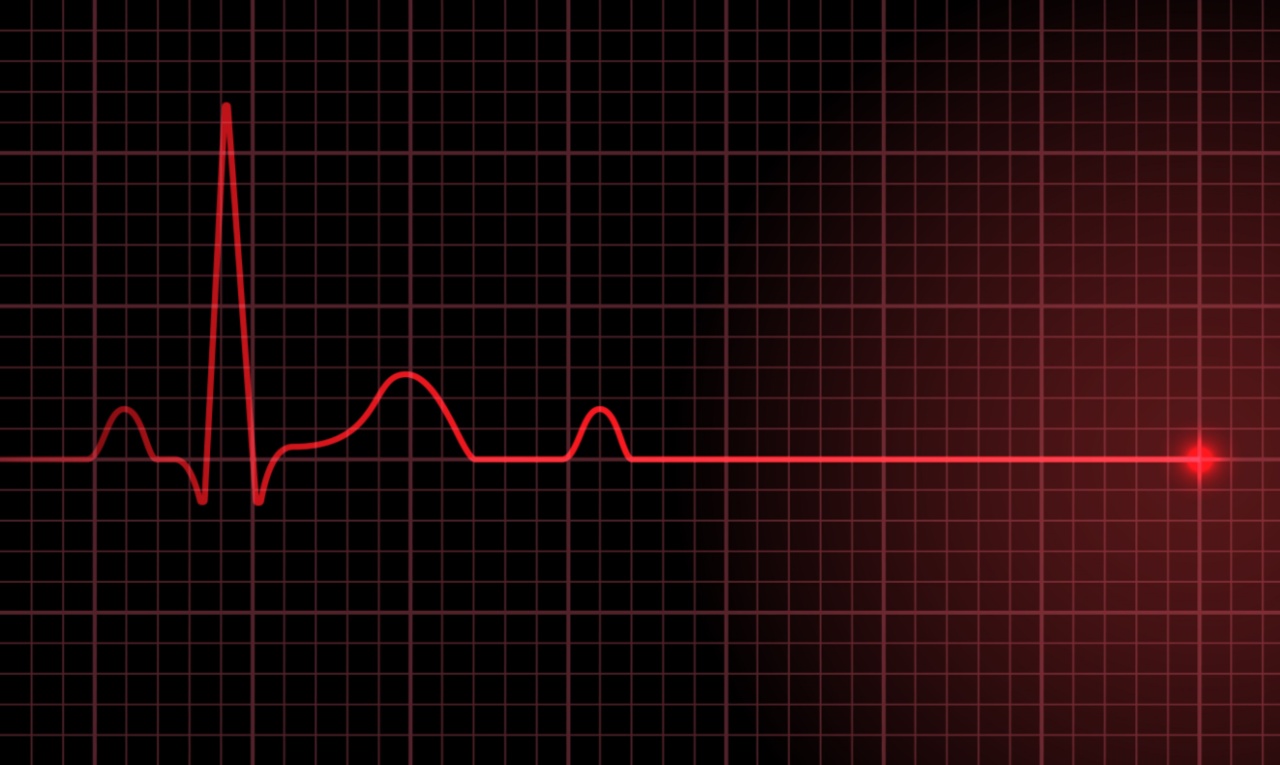 Parada cardíaca: o que é, causas e consequências
