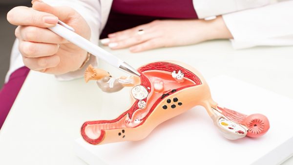 Câncer de ovário: conheça os sintomas para o diagnóstico precoce