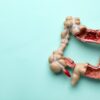 Maio Roxo: entenda as Doenças Inflamatórias Intestinais