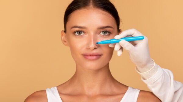 Além da estética: conheça 3 benefícios da rinoplastia