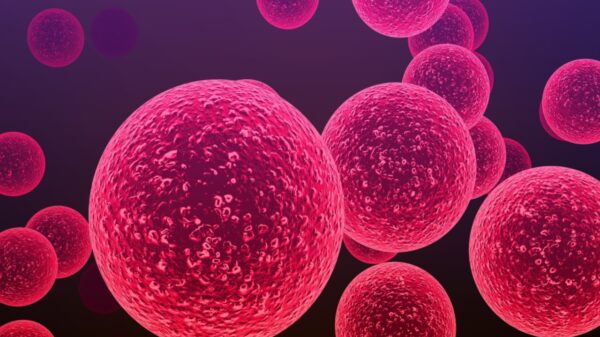 Inglesa quase morre após infecção por bactéria “comedora de carne”