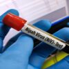 Letal e com alto poder de epidemia: entenda o que é o vírus Nipah