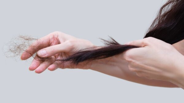 Queda de cabelo? Veja quais alimentos incluir na dieta