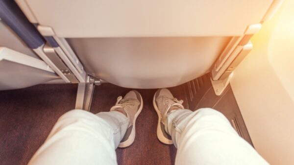 Viagens de avião podem ser perigosas para quem tem varizes; entenda