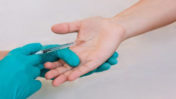 O suor excessivo nas mãos pode ser tratado com botox