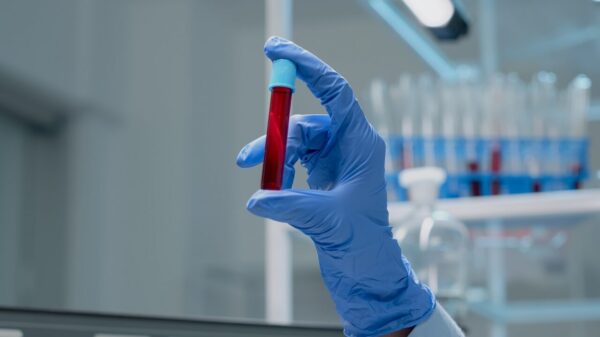 Os mitos e verdades da hemofilia, uma doença rara, que não tem cura
