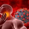 Quatro dicas de como tentar prevenir a mononucleose, a doença do beijo