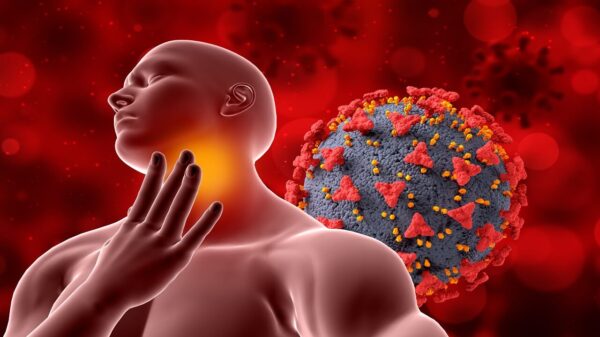 Quatro dicas de como tentar prevenir a mononucleose, a doença do beijo