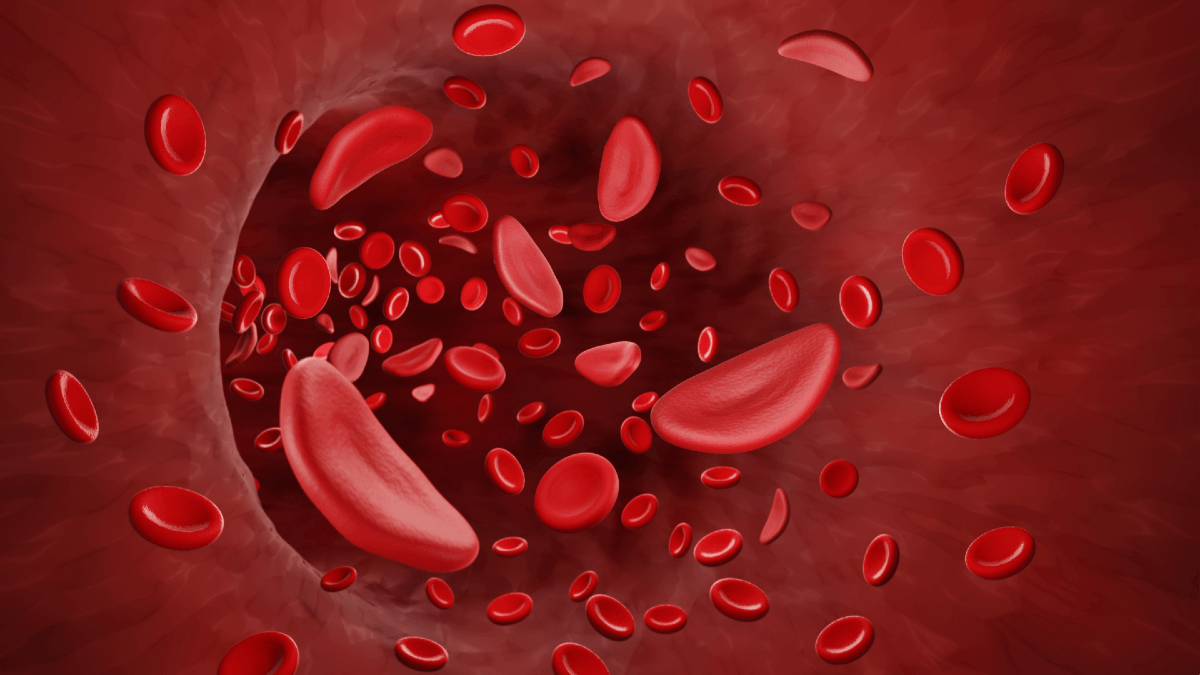 Anemia: entenda os tipos e as causas da condição