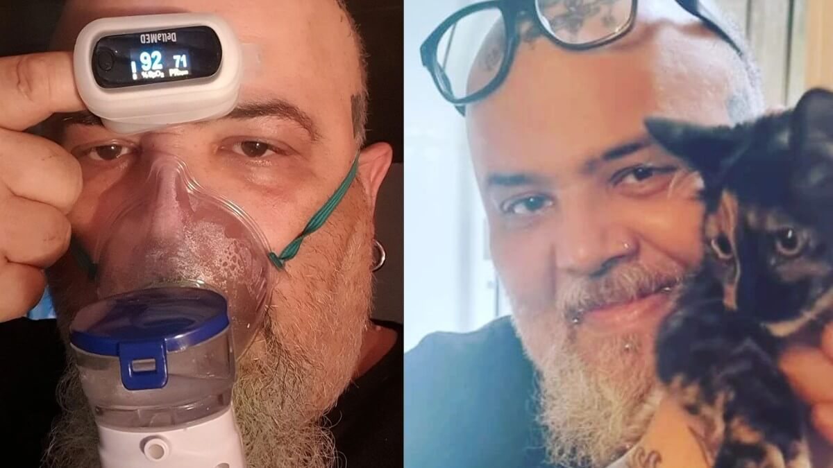 João Gordo revela que tem doença pulmonar crônica; médico comenta