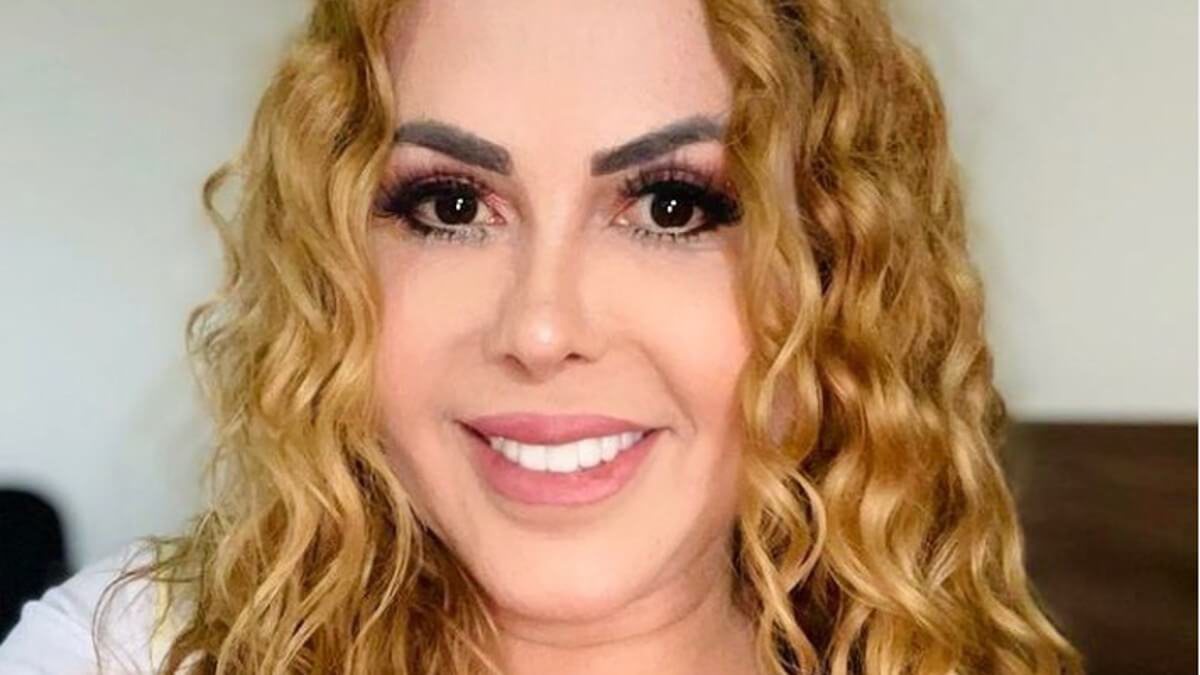 A assessoria de Joelma afirma que o inchaço é sequela da Covid-19. Especialista explica relação e impacto dos medicamentos