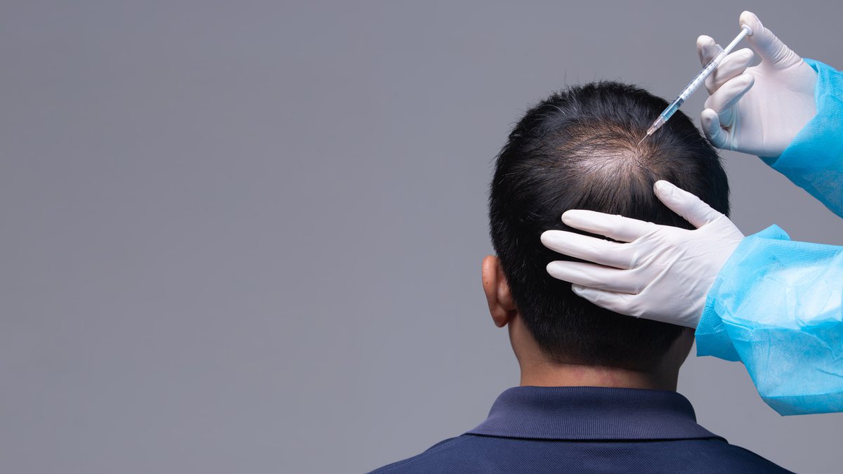 Queda de cabelo: Quais são as causas e o tratamento?