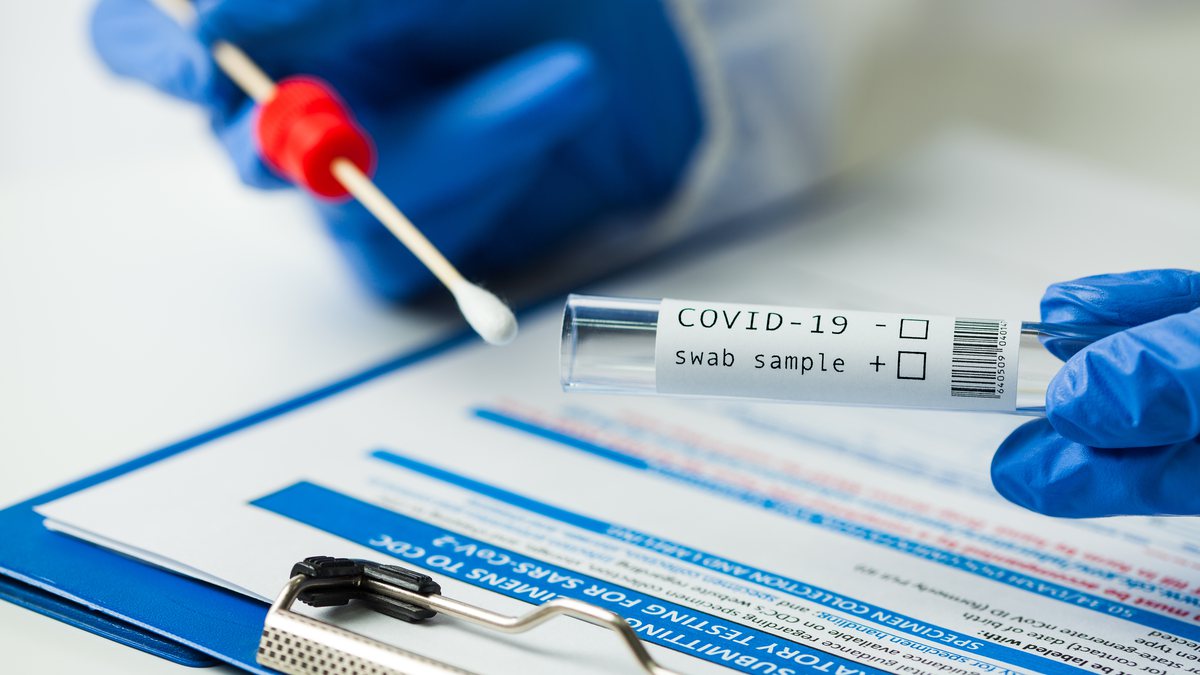 Saiba as diferenças entre os testes que detectam a Covid-19