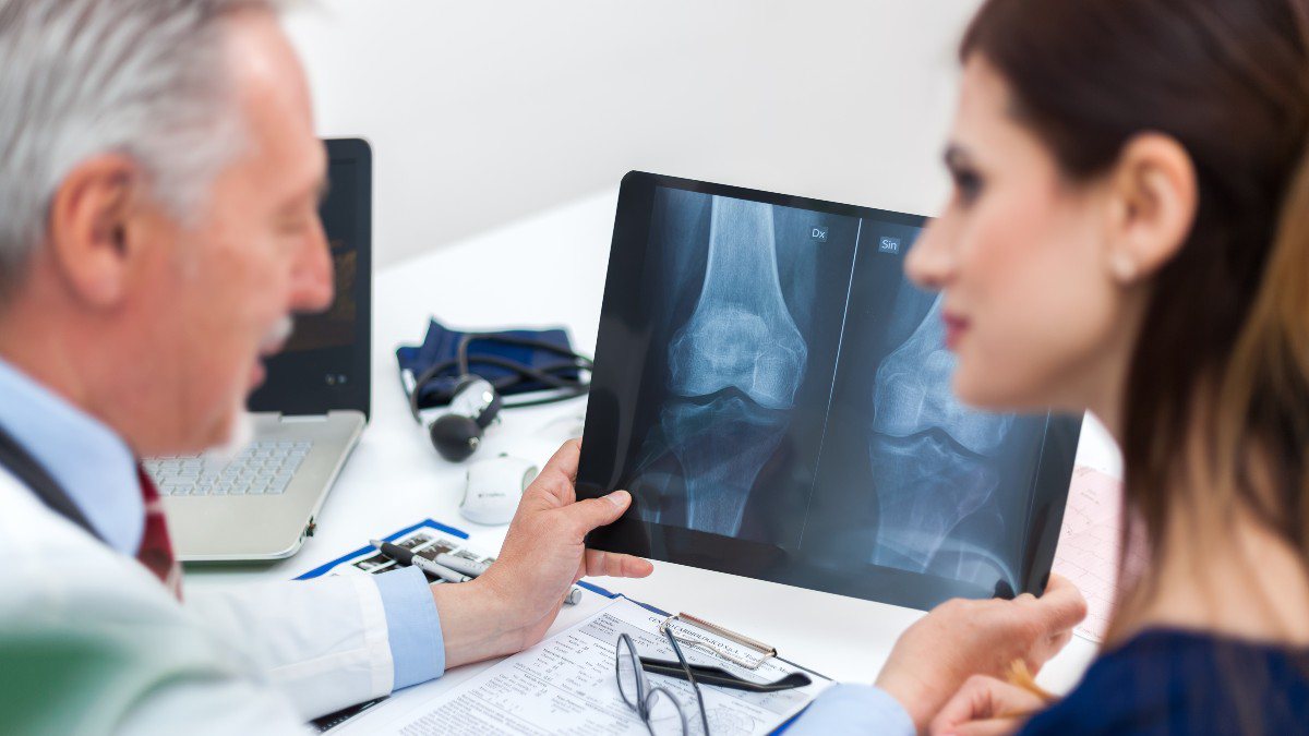 Dia Mundial e Nacional da Osteoporose: evite a doença que atinge 15 milhões de brasileiros