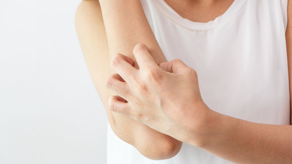 Dermatite atópica: Causa, sintomas e tratamento