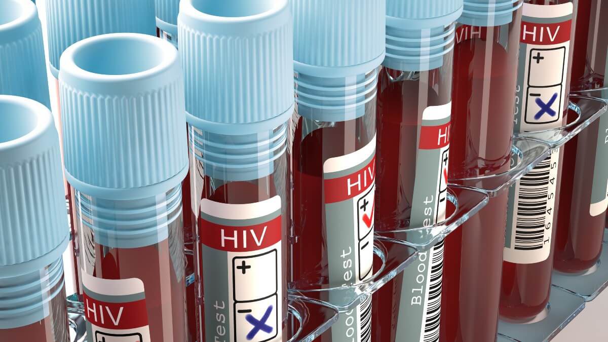 Nova variante do HIV: o que se sabe até o momento